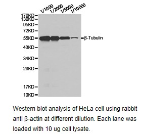 Western blot.