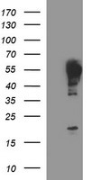HEK293T cells were transfected with the pCMV6-ENTRY control (Left lane) or pCMV6-ENTRY TUBB2A (Right lane) cDNA for 48 hrs and lysed. Equivalent amounts of cell lysates (5 ug per lane) were separated by SDS-PAGE and immunoblotted with anti-TUBB2A.