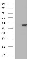 HEK293T cells were transfected with the pCMV6-ENTRY control (Left lane) or pCMV6-ENTRY TUBB2B (Right lane) cDNA for 48 hrs and lysed. Equivalent amounts of cell lysates (5 ug per lane) were separated by SDS-PAGE and immunoblotted with anti-TUBB2B.