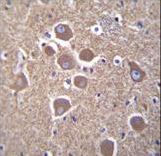 TUBB2B Antibody immunohistochemistry of formalin-fixed and paraffin-embedded human brain tissue followed by peroxidase-conjugated secondary antibody and DAB staining.