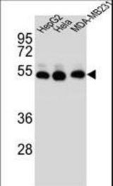 TUBB2B Antibody western blot of HepG2,HeLa,MDA-MB231 cell line lysates (35 ug/lane). The TUBB2B antibody detected the TUBB2B protein (arrow).