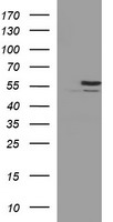 HEK293T cells were transfected with the pCMV6-ENTRY control (Left lane) or pCMV6-ENTRY TUBB2B (Right lane) cDNA for 48 hrs and lysed. Equivalent amounts of cell lysates (5 ug per lane) were separated by SDS-PAGE and immunoblotted with anti-TUBB2B.