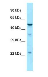 TUBB3 / Tubulin Beta 3 antibody Western Blot of Fetal Brain.