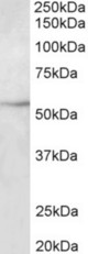 TUBB3 antibody (2 ug/ml) staining of HepG2 lysate (35 ug protein in RIPA buffer). Primary incubation was 1 hour. Detected by chemiluminescence.