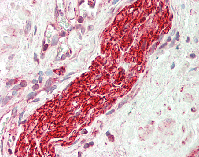 Human Prostate, Nerve: Formalin-Fixed, Paraffin-Embedded (FFPE)