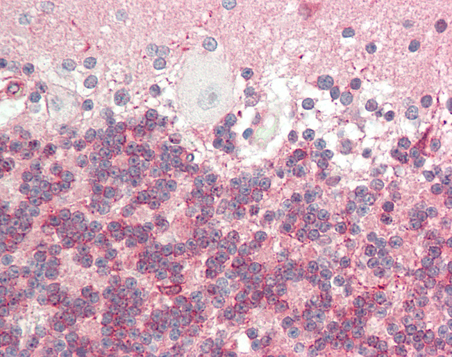 Human Brain, Cerebellum: Formalin-Fixed, Paraffin-Embedded (FFPE)