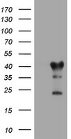 HEK293T cells were transfected with the pCMV6-ENTRY control (Left lane) or pCMV6-ENTRY TMEM173 (Right lane) cDNA for 48 hrs and lysed. Equivalent amounts of cell lysates (5 ug per lane) were separated by SDS-PAGE and immunoblotted with anti-TMEM173.