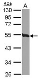 Sample (30 ug of whole cell lysate) A: 293T 10% SDS PAGE TUBB2C antibody diluted at 1:500