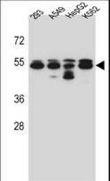 TUBB8 Antibody western blot of 293,A549,HepG2,K562 cell line lysates (35 ug/lane). The TUBB8 antibody detected the TUBB8 protein (arrow).