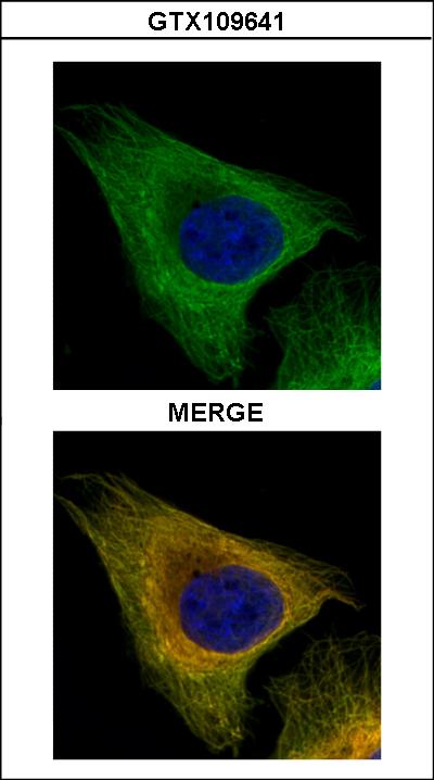 Confocal immunofluorescence analysis (Olympus FV10i) of paraformaldehyde-fixed U2OS using beta Tubulin 8 antibody (Green) at 1:500 dilution. Alpha-tubulin filaments were labeled with alpha-tubulin antibody (Red) at 1:2000.