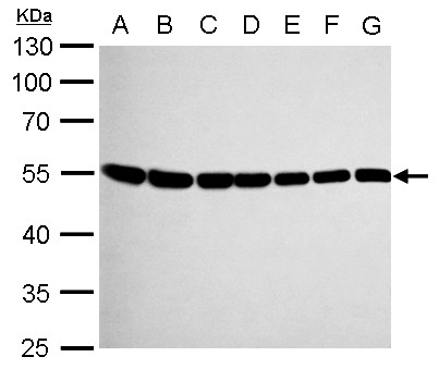 beta Tubulin 8 antibody [C2C3], C-term detects RP11-631M21.2 protein by Western blot analysis. A. 30 ug Neuro2A whole cell lysate/extract. B. 30 ug GL261 whole cell lysate/extract. C. 30 ug C8D30 whole cell lysate/extract. D. 30 ug NIH-3T3 whole cell lysate/extract. E. 30 ug BCL-1 whole cell lysate/extract. F. 30 ug Raw264.7 whole cell lysate/extract. G. 30 ug C2C12 whole cell lysate/extract. 10 % SDS-PAGE. beta Tubulin 8 antibody [C2C3], C-term dilution:1:1000