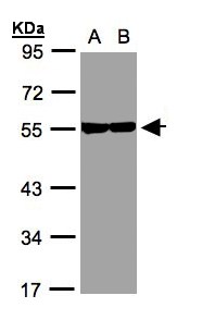 Sample (30 ug whole cell lysate). A: A431, B: H1299. 10% SDS PAGE. TUBB8 antibody diluted at 1:1000