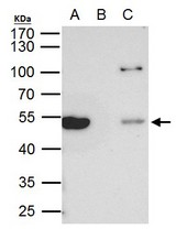 beta Tubulin 8 antibody immunoprecipitates beta Tubulin 8 protein in IP experiments. IP Sample:293T whole cell lysate/extract. A. 40 ug 293T whole cell lysate/extract. B. Control with 2 ug of preimmune rabbit IgG. C. Immunoprecipitation of beta Tubulin 8 protein by 2 ug of beta Tubulin 8 antibody . 10% SDS-PAGE. The immunoprecipitated beta Tubulin 8 protein was detected by beta Tubulin 8 antibody diluted at 1:1000. EasyBlot anti-rabbit IgG (anti-rabbit IgG (HRP) -01) was used as a secondary reagent.