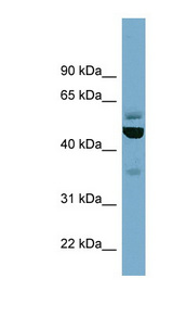 TUBE1 antibody LS-C107920 Western blot of HeLa lysate.