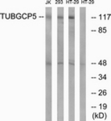 Western blot of extracts from HT-29/Jurkat/293 cells, using TUBGCP5 Antibody. The lane on the right is treated with the synthesized peptide.