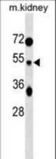 TUFT1 Antibody western blot of mouse kidney tissue lysates (35 ug/lane). The TUFT1 antibody detected the TUFT1 protein (arrow).