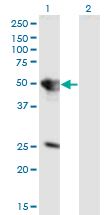 Western Blot analysis of TUFT1 expression in transfected 293T cell line by TUFT1 monoclonal antibody (M01), clone 2C10.Lane 1: TUFT1 transfected lysate (Predicted MW: 44.3 KDa).Lane 2: Non-transfected lysate.