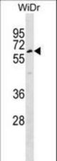 TULP1 Antibody western blot of WiDr cell line lysates (35 ug/lane). The TULP1 antibody detected the TULP1 protein (arrow).