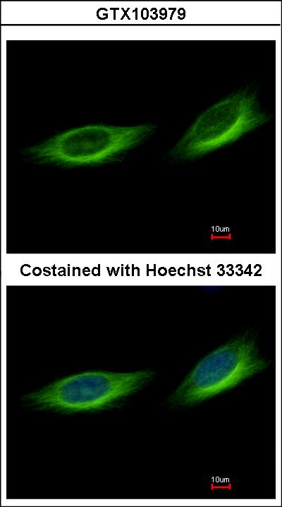 Immunofluorescence of methanol-fixed HeLa using TULP1 antibody at 1:500 dilution.