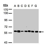 Sample (30 ug whole cell lysate). A:293T, B: A431 , C: H1299, D: HeLa S3 , E: Hep G2 . F: MOLT4 . G: Raji . 7.5% SDS PAGE. TULP1 antibody diluted at 1:1000