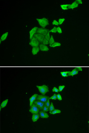Immunofluorescence analysis of U2OS cell using TUSC2 antibody. Blue: DAPI for nuclear staining.