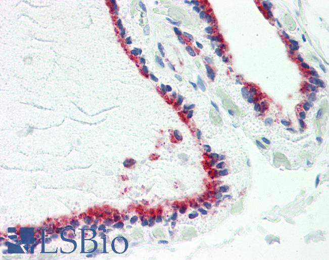 Anti-TUSC2 / PAP antibody IHC staining of human thyroid. Immunohistochemistry of formalin-fixed, paraffin-embedded tissue after heat-induced antigen retrieval. Antibody LS-B9915 concentration 10 ug/ml.