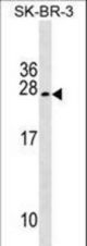 TUSC5 Antibody western blot of SK-BR-3 cell line lysates (35 ug/lane). The TUSC5 antibody detected the TUSC5 protein (arrow).