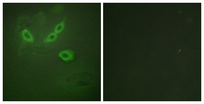 Immunofluorescence of HeLa cells, using TUSC5 Antibody. The picture on the right is treated with the synthesized peptide.