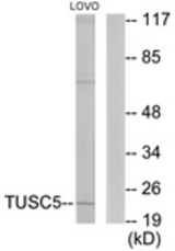 Western blot of extracts from LOVO cells, using TUSC5 Antibody. The lane on the right is treated with the synthesized peptide.