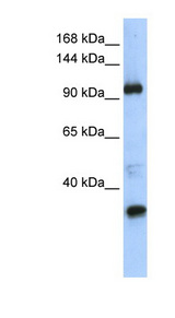 TUT1 antibody LS-C101778 Western blot of Transfected 293T cell lysate.