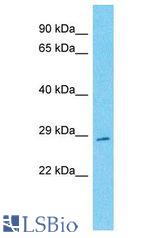 TVP23C antibody Western Blot of HeLa. Antibody dilution: 1 ug/ml.