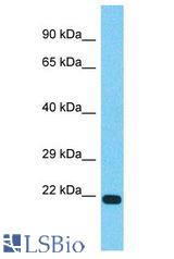 TVP23C antibody Western Blot of MCF7. Antibody dilution: 1 ug/ml.