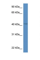TWF1 / PTK9 antibody LS-C145235 Western blot of Rat Brain lysate. Antibody concentration 1 ug/ml.