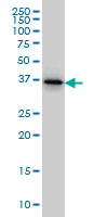 PTK9 monoclonal antibody (M02), clone 1E2 Western blot of PTK9 expression in HeLa.
