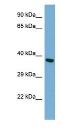 TWF2 / PTK9L antibody Western Blot of HepG2 cell lysate.