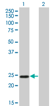 Western Blot analysis of TWIST1 expression in transfected 293T cell line by TWIST1 monoclonal antibody (M01), clone 3E11.Lane 1: TWIST1 transfected lysate(21 KDa).Lane 2: Non-transfected lysate.