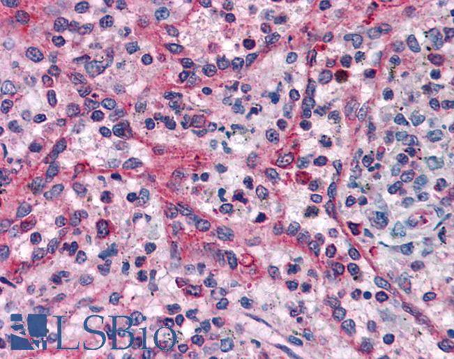 Anti-TMX1 / TXNDC antibody IHC of human spleen. Immunohistochemistry of formalin-fixed, paraffin-embedded tissue after heat-induced antigen retrieval. Antibody LS-B4919 concentration 3.75 ug/ml.
