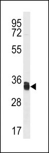 TMX1 Antibody western blot of Jurkat cell line lysates (35 ug/lane). The TMX1 antibody detected the TMX1 protein (arrow).