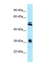 TMX1 / TXNDC antibody LS-C146019 Western blot of HepG2 Cell lysate. Antibody concentration 1 ug/ml.