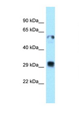 TMX1 / TXNDC antibody LS-C146020 Western blot of Fetal Lung lysate. Antibody concentration 1 ug/ml.