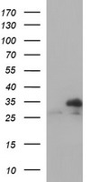 HEK293T cells were transfected with the pCMV6-ENTRY control (Left lane) or pCMV6-ENTRY TMX1 (Right lane) cDNA for 48 hrs and lysed. Equivalent amounts of cell lysates (5 ug per lane) were separated by SDS-PAGE and immunoblotted with anti-TMX1.