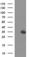 HEK293T cells were transfected with the pCMV6-ENTRY control (Left lane) or pCMV6-ENTRY TMX1 (Right lane) cDNA for 48 hrs and lysed. Equivalent amounts of cell lysates (5 ug per lane) were separated by SDS-PAGE and immunoblotted with anti-TMX1.