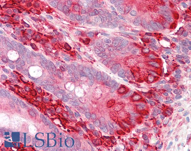 Anti-TXNDC5 / ERP46 antibody IHC staining of human small intestine. Immunohistochemistry of formalin-fixed, paraffin-embedded tissue after heat-induced antigen retrieval.