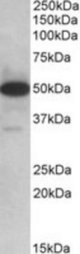 TXNDC5 antibody (0.1 ug/ml) staining of Human Lymph Nodes lysate (35 ug protein/ml in RIPA buffer). Primary incubation was 1 hour. Detected by chemiluminescence.