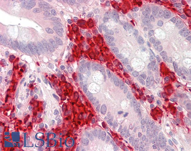Anti-TXNDC5 / ERP46 antibody IHC staining of human small intestine. Immunohistochemistry of formalin-fixed, paraffin-embedded tissue after heat-induced antigen retrieval.