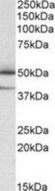 TXNDC5 antibody (0.05 ug/ml) staining of Human Lymph Nodes lysate (35 ug protein/ml in RIPA buffer). Primary incubation was 1 hour. Detected by chemiluminescence.