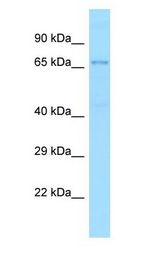 TXNRD3 antibody Western Blot of OVCAR-3.