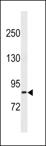 TXNRD3 Antibody western blot of MDA-MB453 cell line lysates (35 ug/lane). The TXNRD3 antibody detected the TXNRD3 protein (arrow).