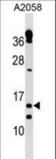TXNRD3IT1 Antibody western blot of A2058 cell line lysates (35 ug/lane). The TXNRD3IT1 antibody detected the TXNRD3IT1 protein (arrow).