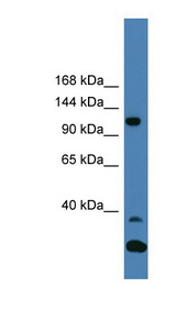 TYK2 antibody LS-C116860 Western blot of COLO205 cell lysate.